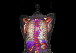 Euro-BioImaging will also provide open access to state-of-the-art biolmedical imaging techniques like the CT scan which generated this image of a human torso.
Image credits: University Medical Centre Mannheim, Medical Faculty Mannheim.