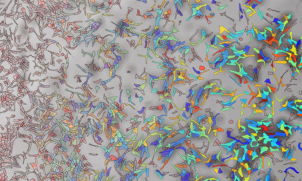 Microscope image of liver cells, highlighted in various colours.